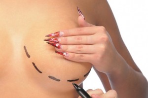 liposculpture-borsten-arenborghoeve-kliniek